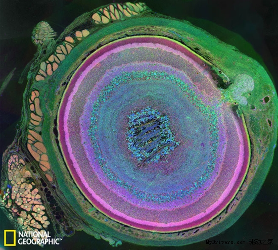 2011年最佳科学摄影：癌细胞似外星生物